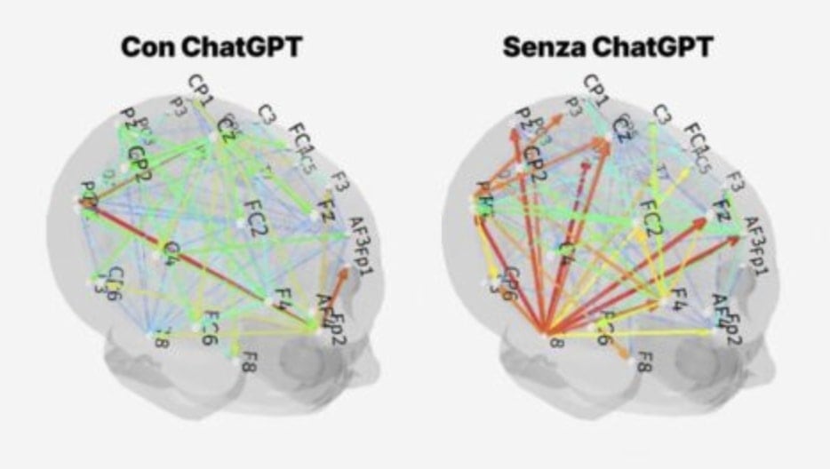 chagpt e il nostro cervello